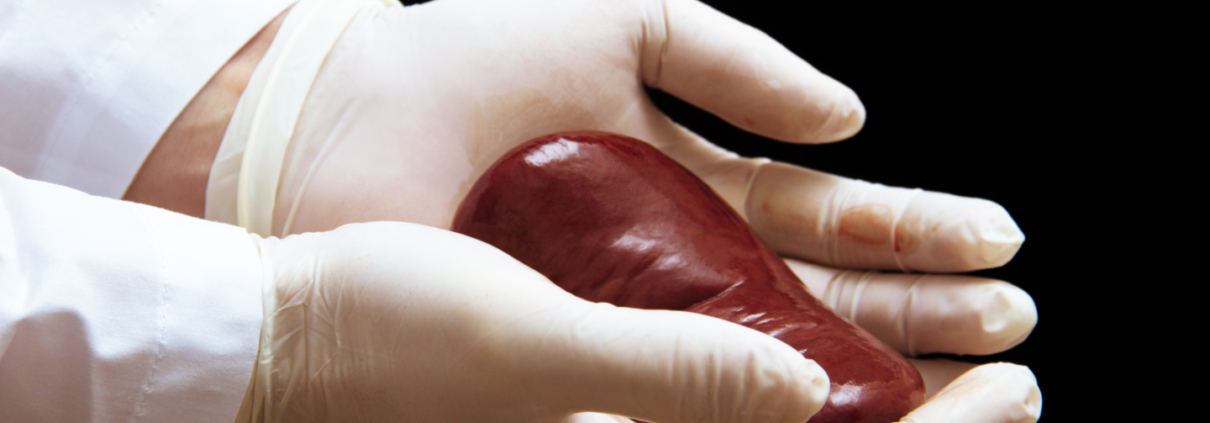Kidney Transplant - absorbent sterile mats to keep surgeon's hands warm