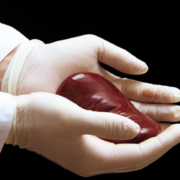 Kidney Transplant - absorbent sterile mats to keep surgeon's hands warm