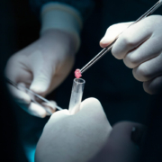 Triple Packaging of Formalin-Fixed Biological Specimens in Hospitals