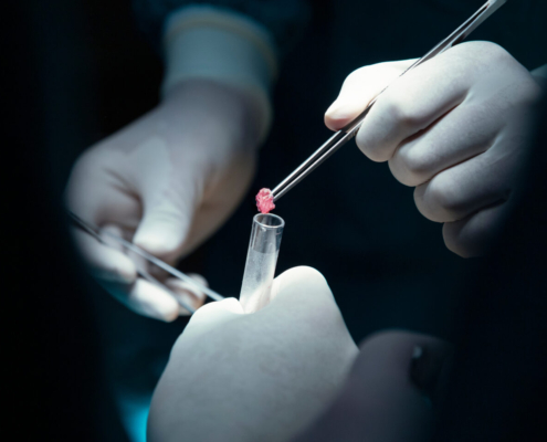 Triple Packaging of Formalin-Fixed Biological Specimens in Hospitals